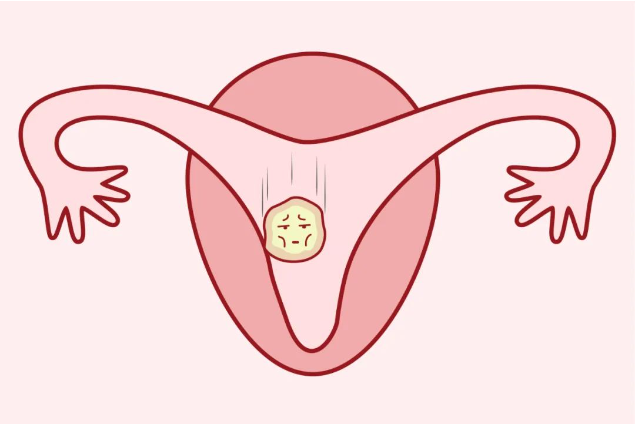 怀孕后该怎么预防胎停呢？